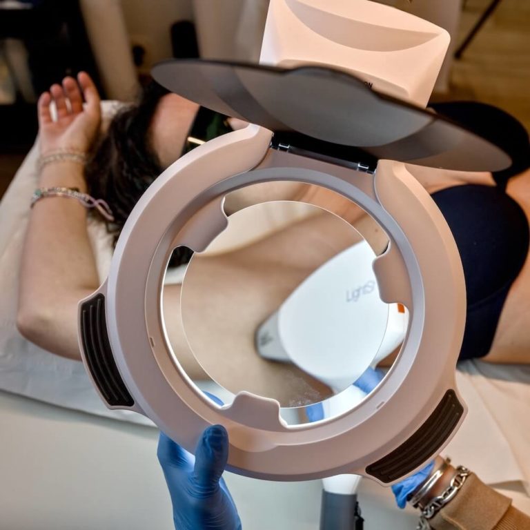 Comment utiliser une crème anesthésiante lors d’une épilation au laser