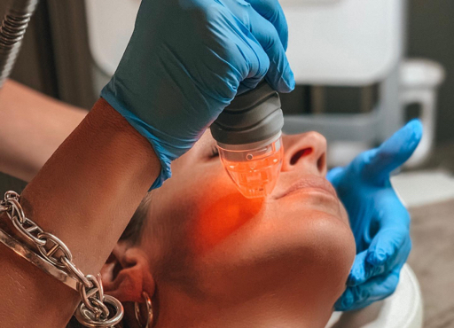 Microneedling